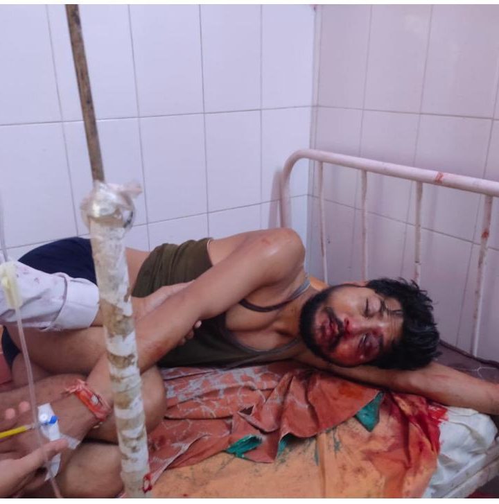 ब्रेकिंग न्यूज़-मानिकपुर कस्बे में पोर्टल न्यूज़ के पत्रकार सूरज तोमर के ऊपर हुआ जानलेवा हमला