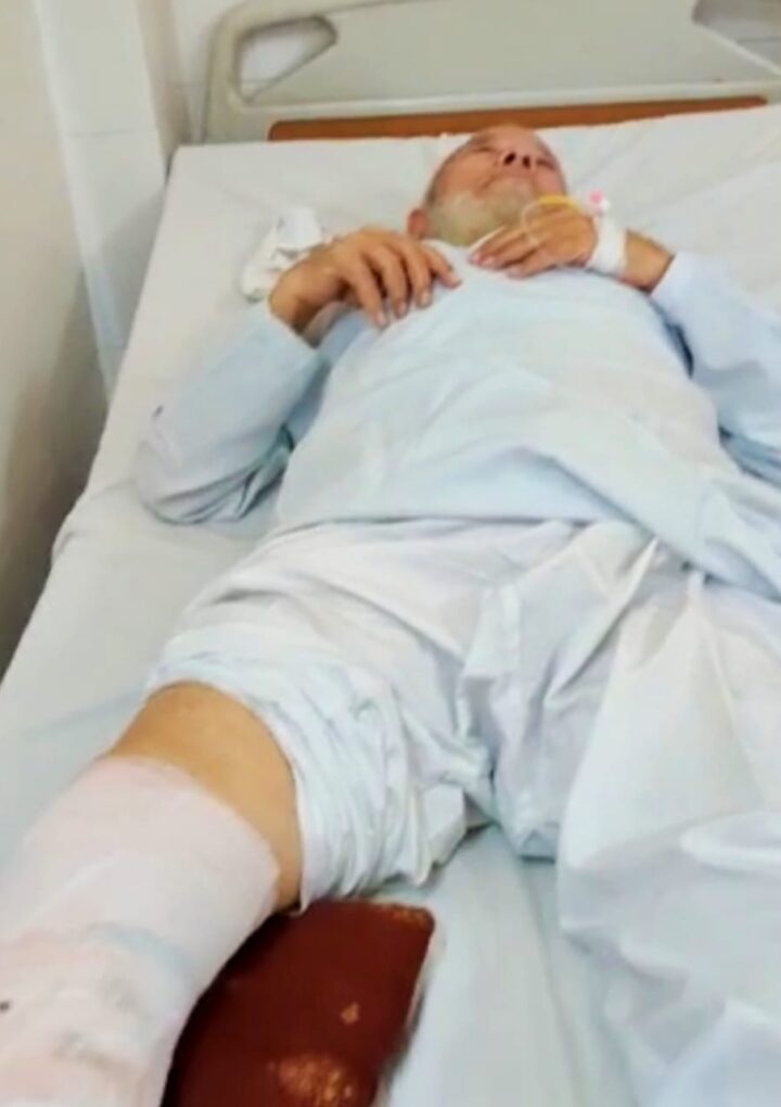 बुजुर्ग को दबंगों ने किया मरणासन्न, पुलिस ने निभाई यारी-हत्या के प्रयास के आरोपियों को शान्तिभंग की कार्यवाही कर छोड़ा।