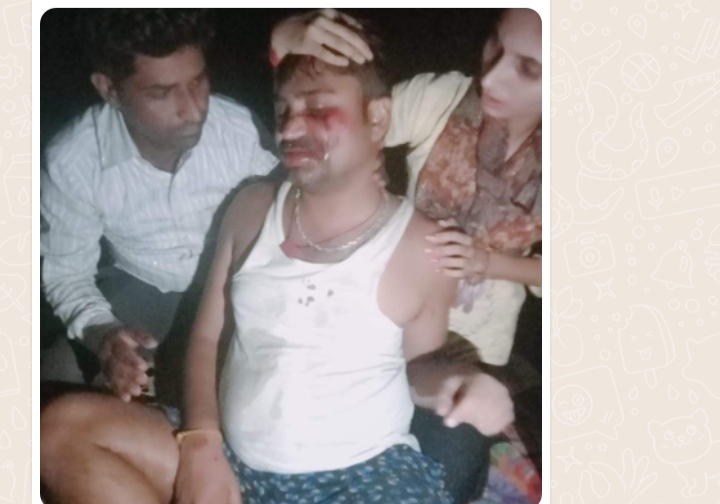 पत्रकार के ऊपर हुआ जानलेवा हमला अयोध्या यूपी