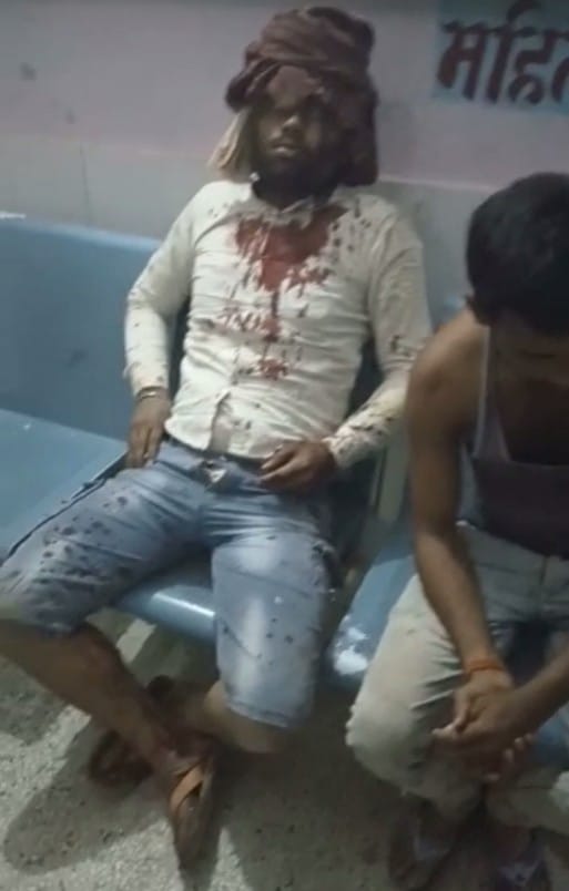 दिवार बनाने को लेकर दबंगो ने की मारपीट, घायल की हालत गम्भीर