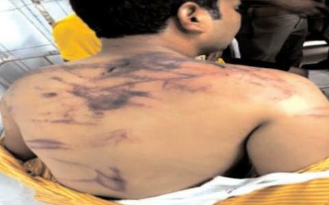 पत्रकार मनीष मौर्य पर दिन दहाड़े जानलेवा हमला और हजारों की लूट