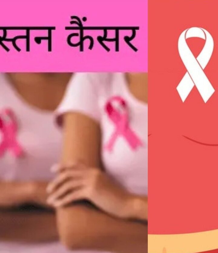 स्तन कैंसर पर विशेष पाठशाला का आज होगा आयोजन . बांदा यूपी